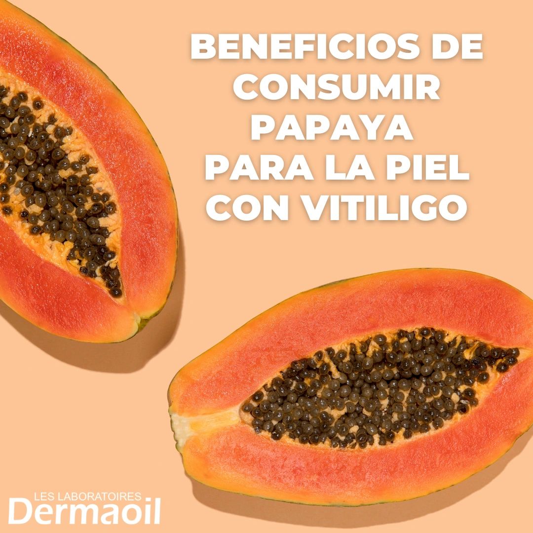 BENEFICIOS DE CONSUMIR PAPAYA PARA LA PIEL CON VITILIGO